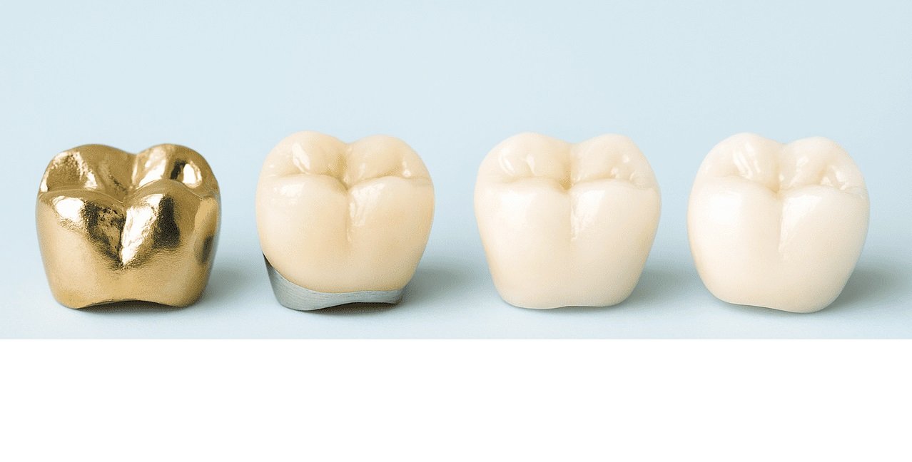 Коронки для зубів. Типи