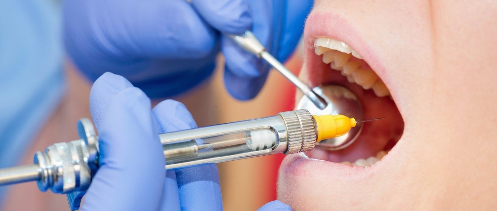 Анестезія у стоматології